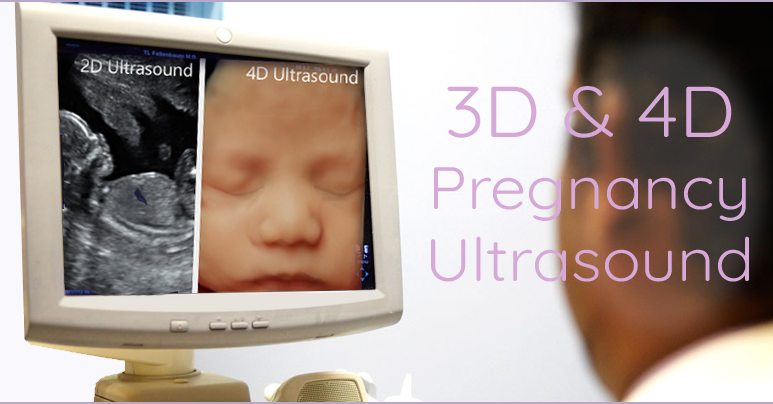 4d ultrasound flint
